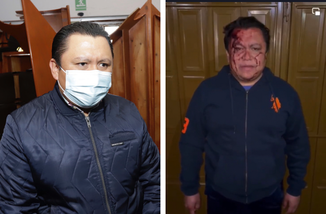 Gonzalo Juárez, líder del sindicato del Ayuntamiento de Puebla denuncia ataque