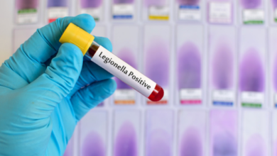 Legionella, legionelosis o enfermedad de los legionarios: qué es